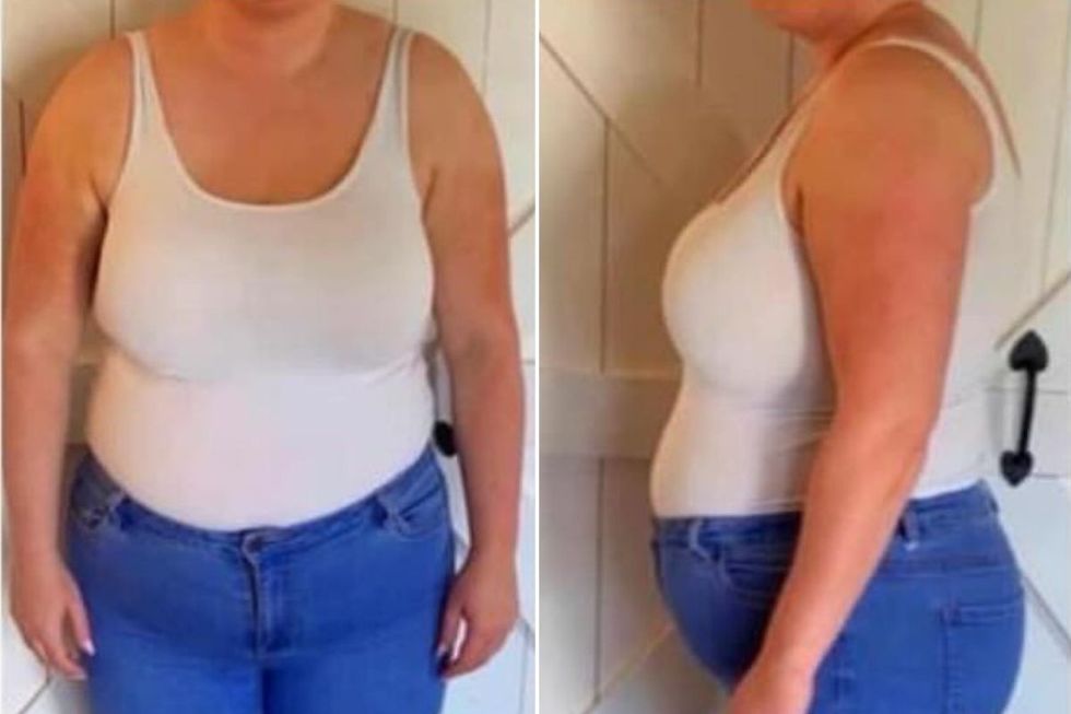 Claire spencer before and after