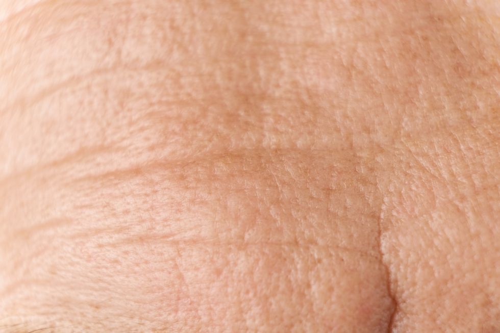CLOSE UP OF FACIAL PORES