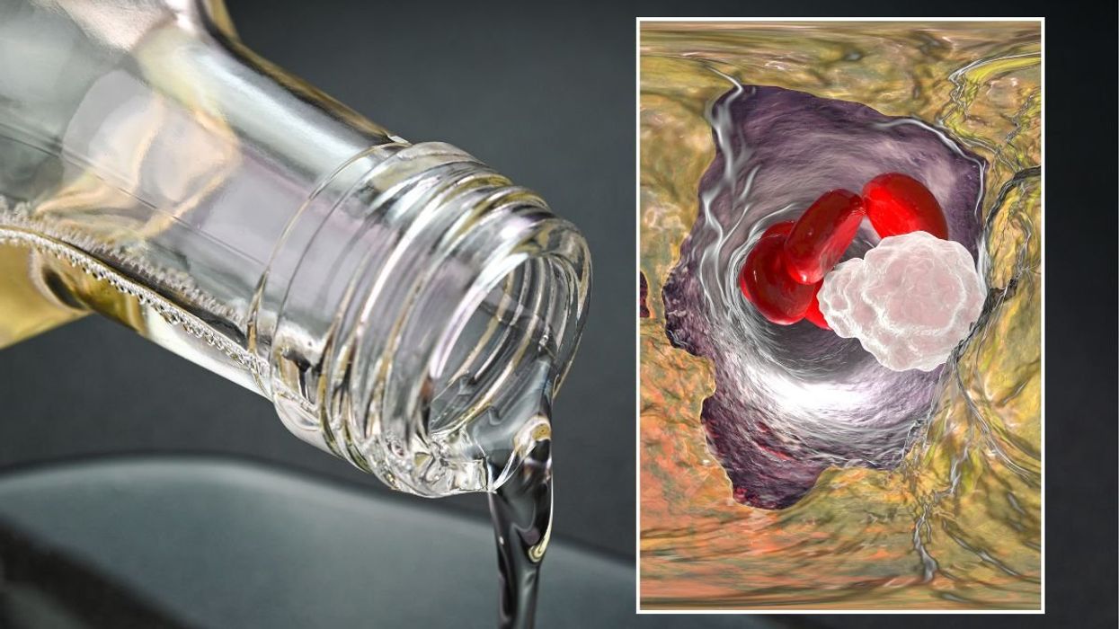 Coconut oil being poured and high cholesterol