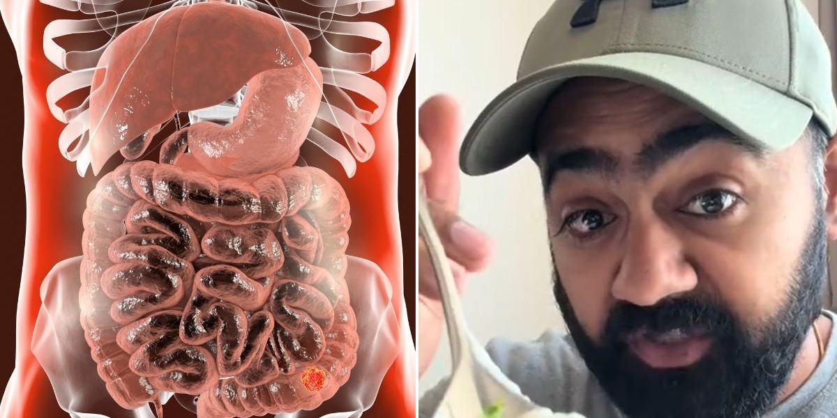 NextImg:'I'm a GP and I eat these four dietary staples every single day to cut my colon cancer risk'