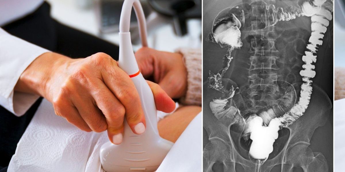 NextImg:Scientists hail 'huge effect' of daily pill that slashes risk of colon cancer returning by 55%