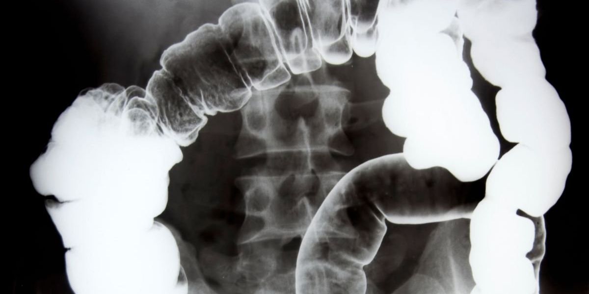 Surgeon warns patients are ignoring five ‘worrying features’ Surgeon warns patients are ignoring five ‘worrying features’