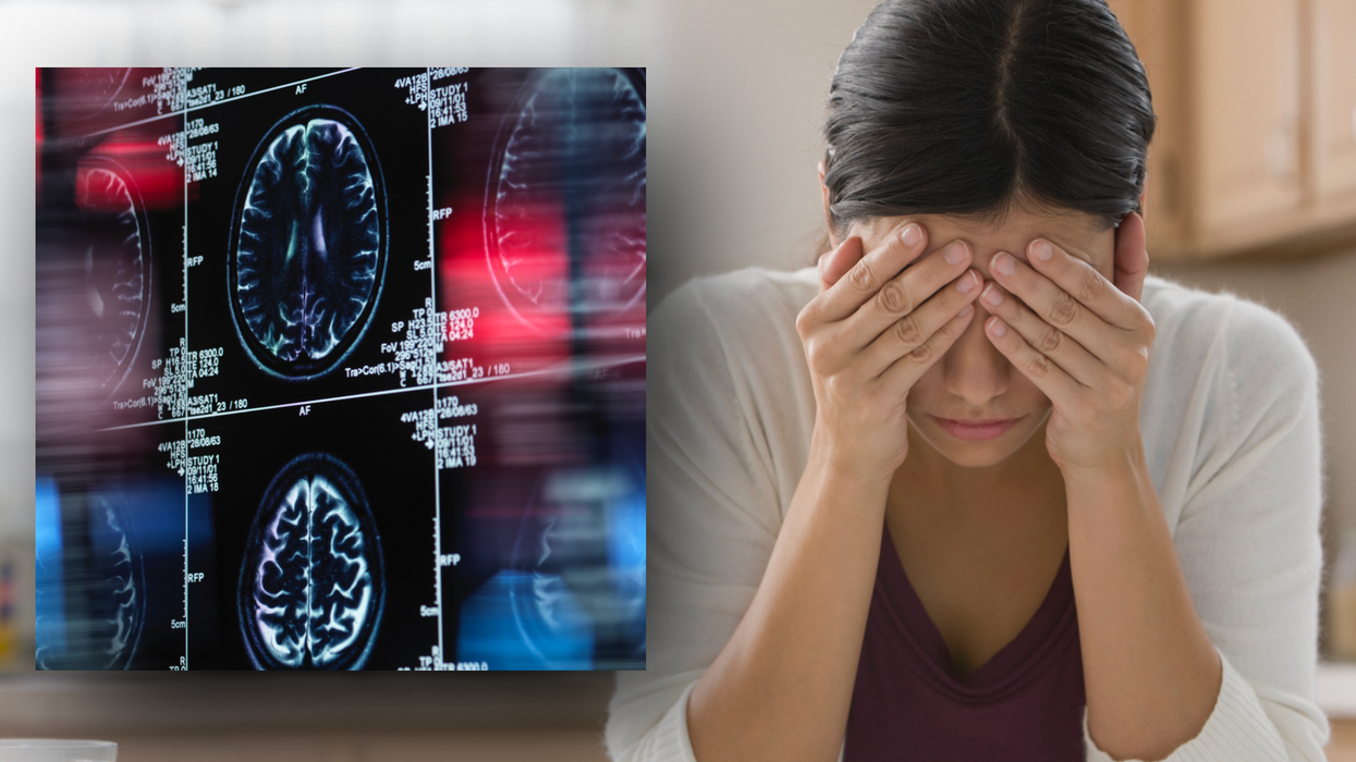 Composite image of a brain and dementia