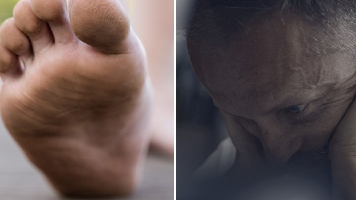 Composite image of a foot and man holding his head in pain