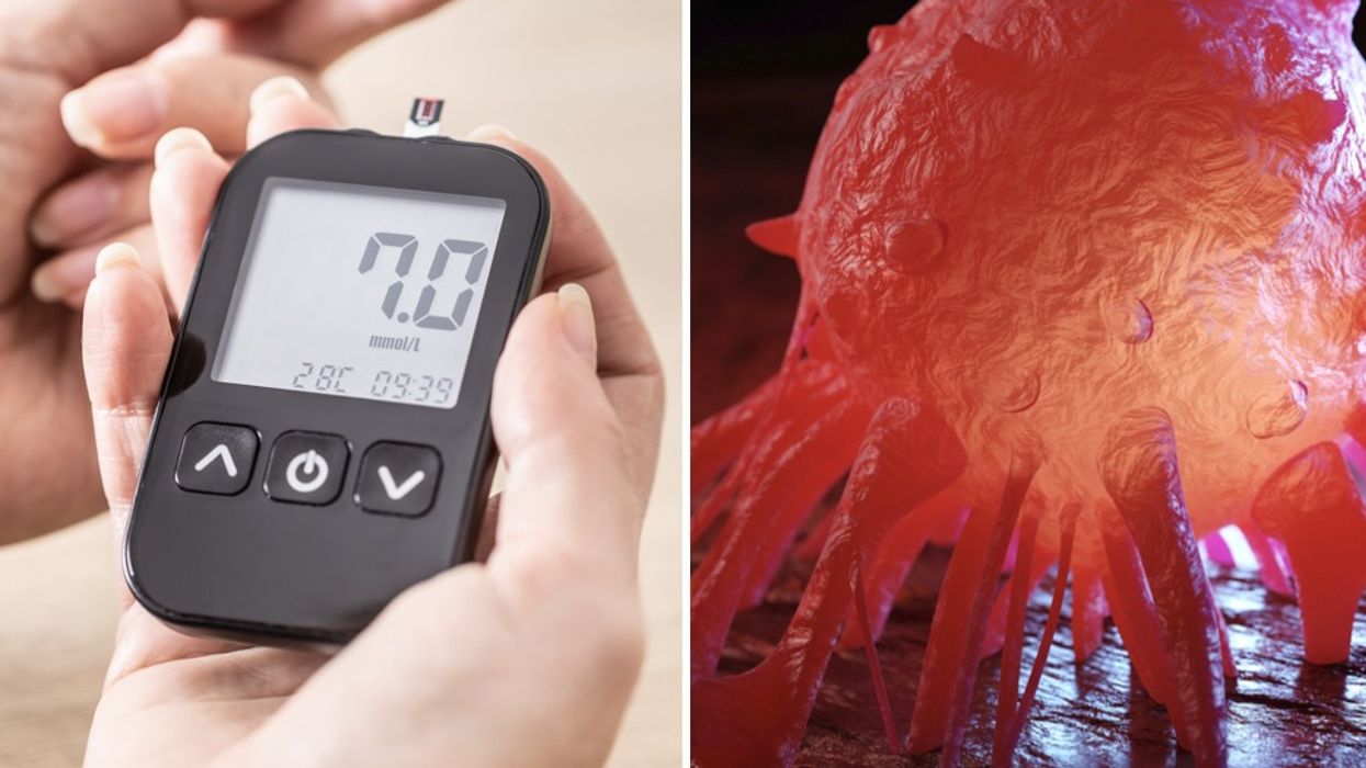 Composite image of a person getting their blood sugar tested and cancer cell