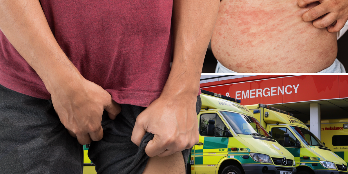NextImg:'Don't ignore!': Urgent health warning over the 'nasty' symptoms of scabies as cases in England skyrocket