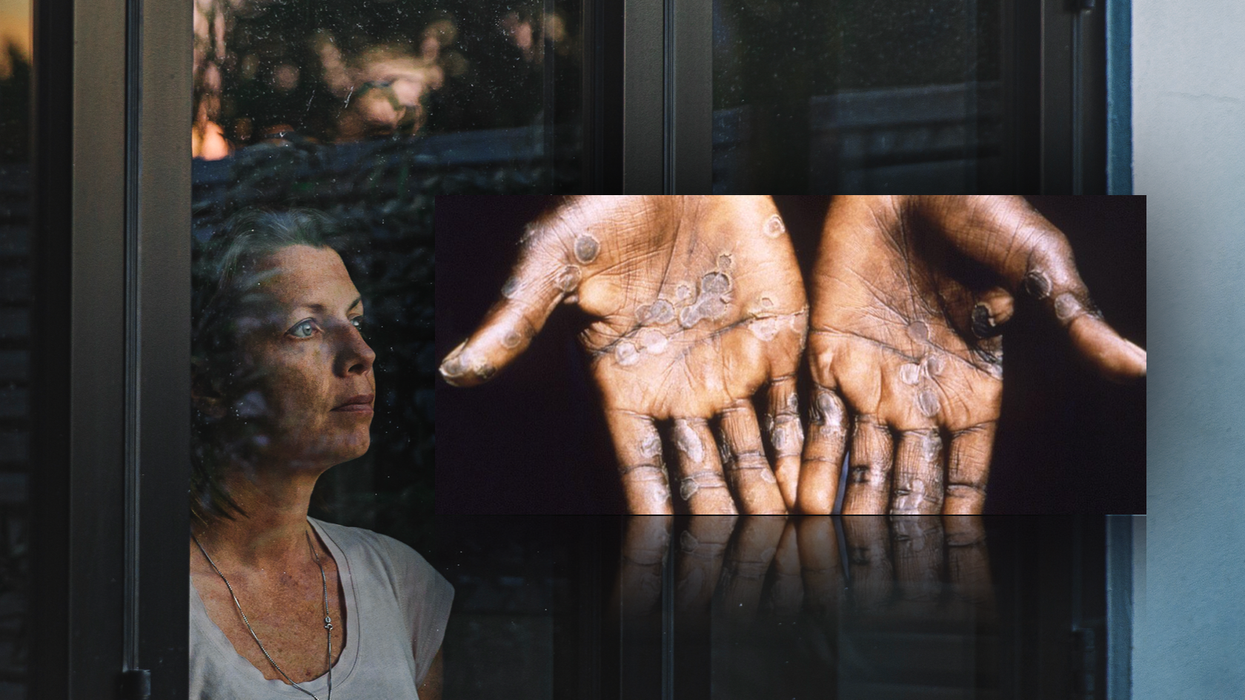 Composite image of a woman looking out the window and blister hands