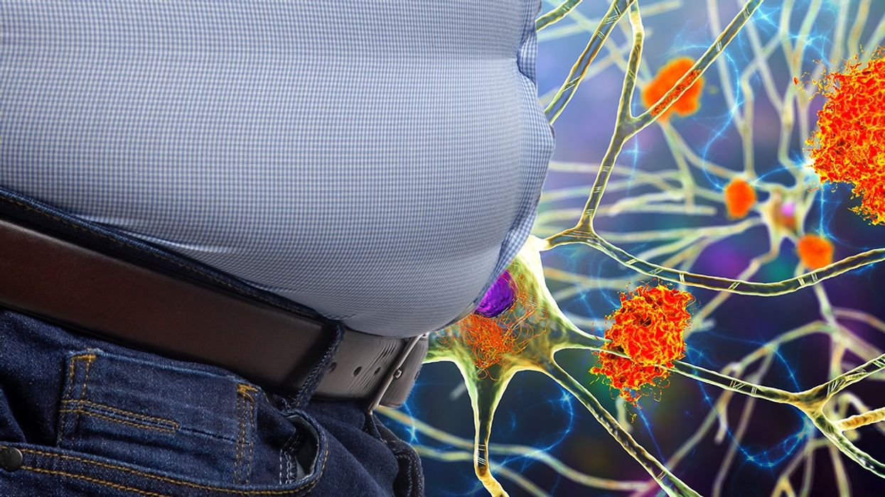 Composite image of belly fat and Alzheimer's clumps