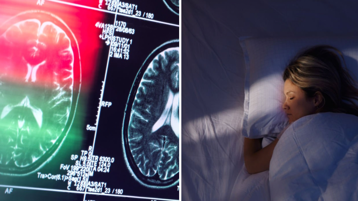 Composite image of brain scan and woman sleeping in bed