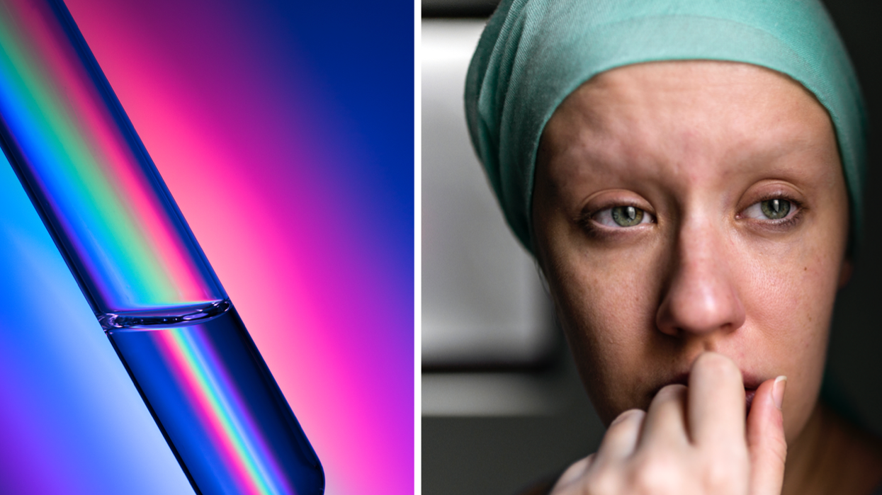 Composite image of glowing dye and worried cancer patient