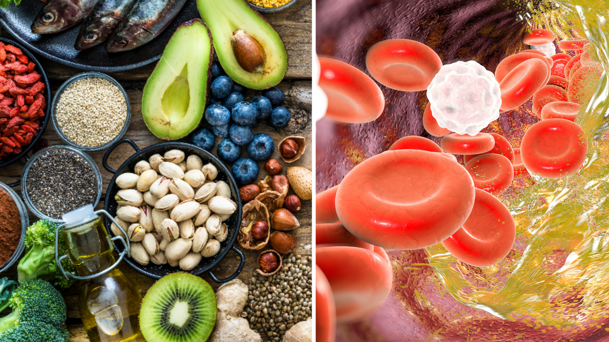 Composite image of healthy diet consisting of nuts, fruit and fish next to a graphic of high cholesterol plaque in the body