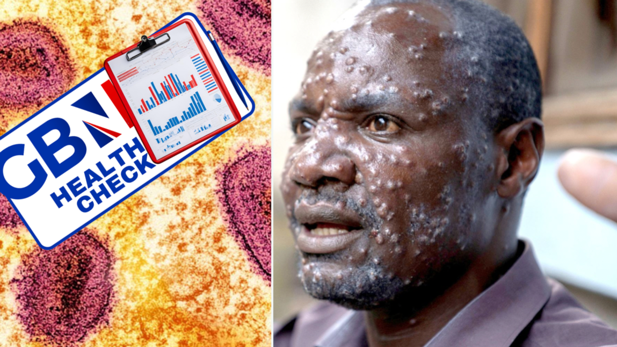 Composite image of mpox virus particles and a man with mpox blisters on his face