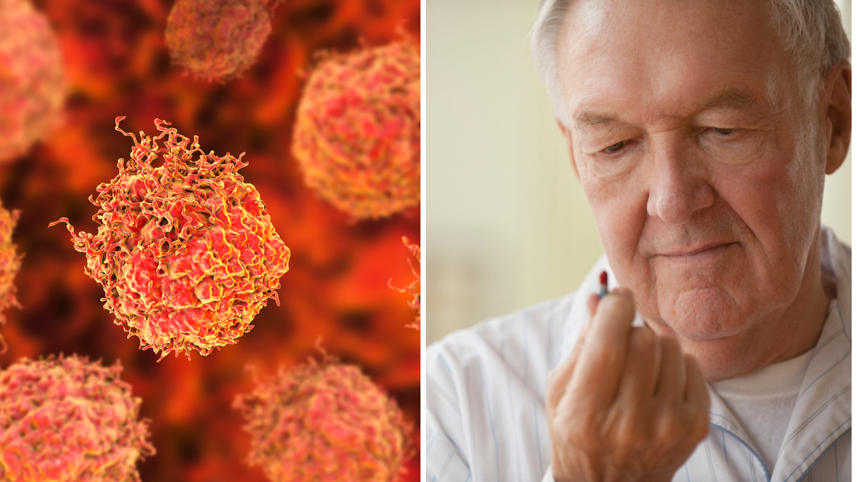 Composite image of prostate cancer cells and a man about to take a pill