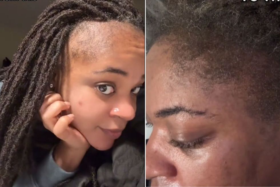 CORINE BEFORE AND AFTER PICTURES