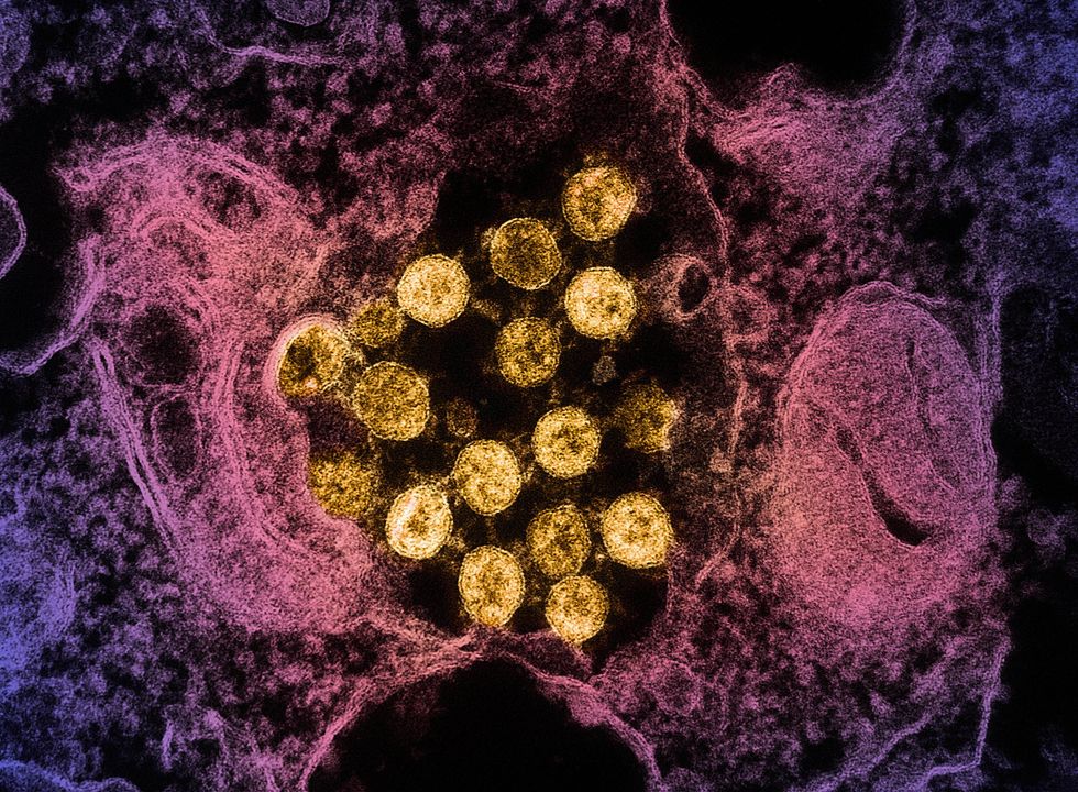 COVID UNDER MICROSCOPE