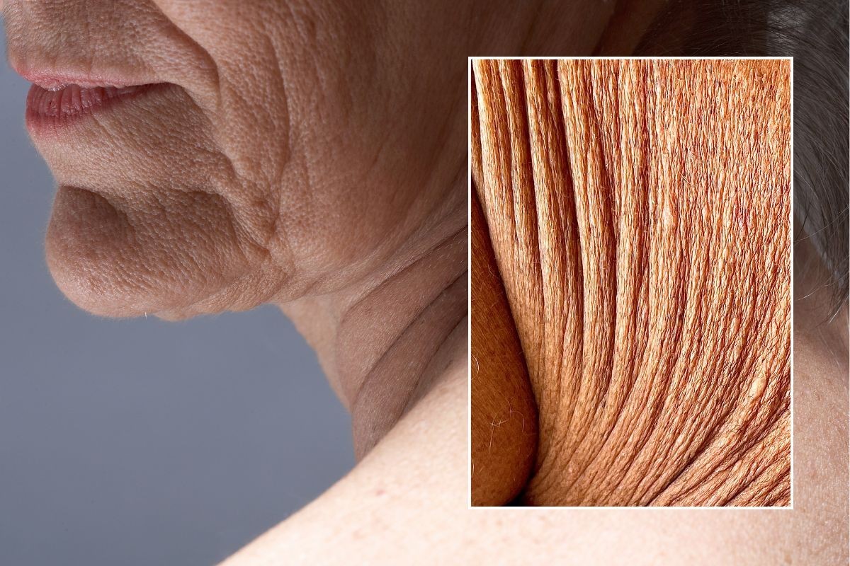 Crepey skin: The top dietary measures to stop skin sagging - and how to ...