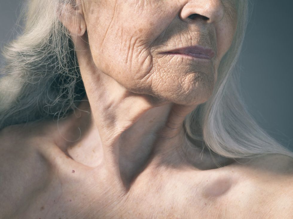 Crepey skin on older woman
