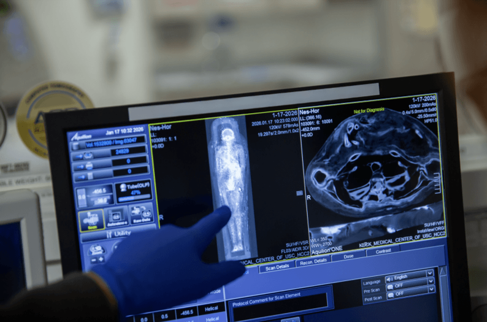 CT scanner results of ancient Egyptian mummy