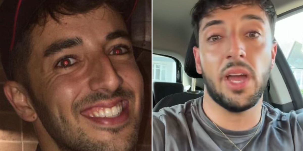 NextImg:Briton, 31, describes 'weird' cancer symptom that showed up on his skin 'early on'