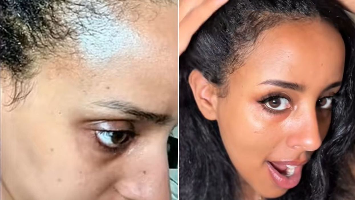 DANIELLA BEFORE AND AFTER