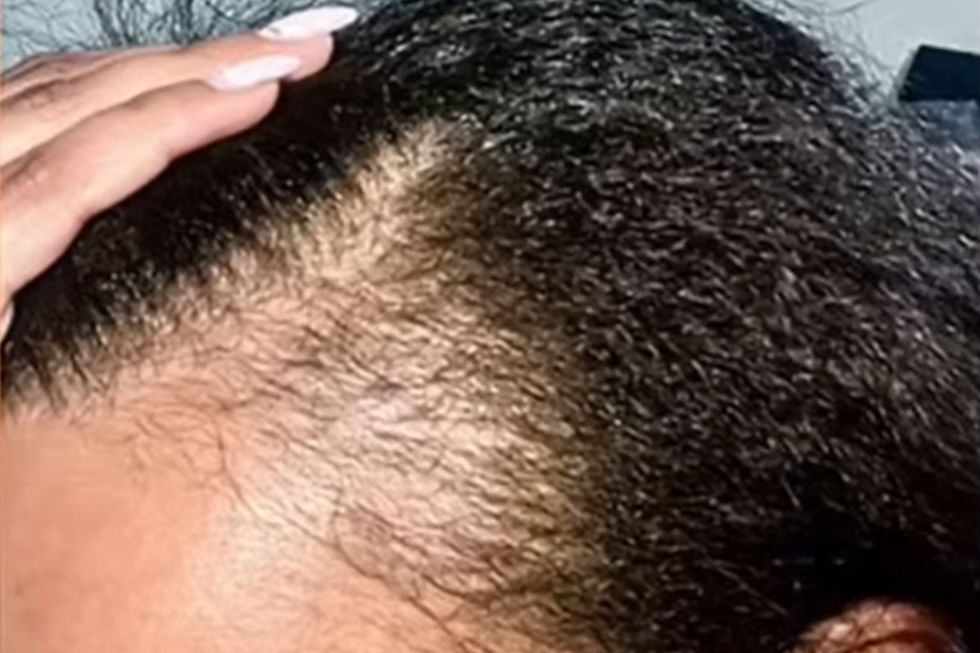 Daniella before picture