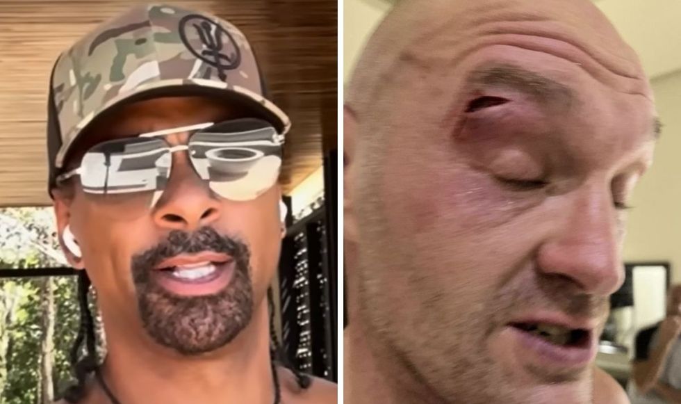 David Haye has spoke out on Tyson Fury's injury