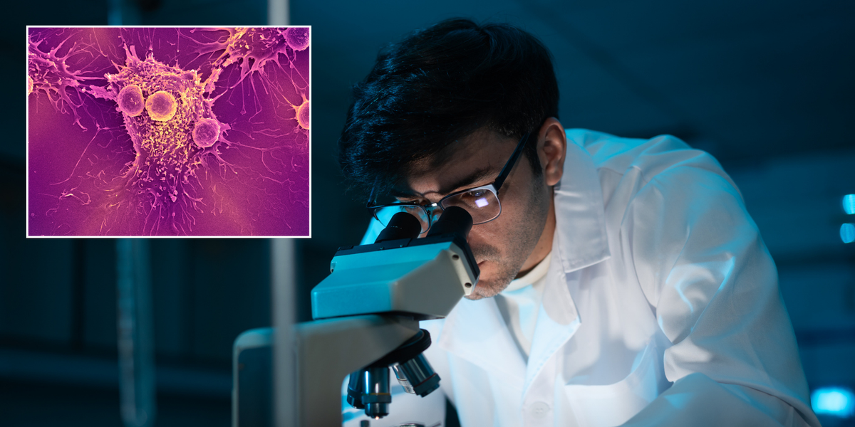 NextImg:Cancer breakthrough as scientists discover ‘switch’ that can revert disease infected cells