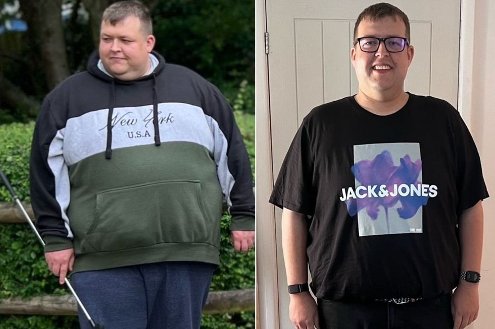 Dean before and after pictures