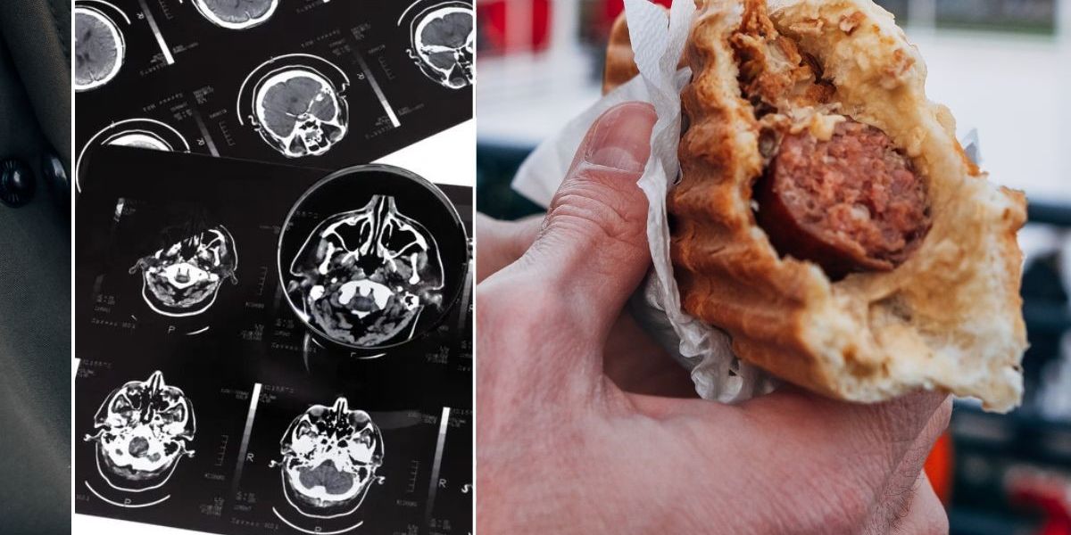 NextImg:Scientists identify key foods linked to faster dementia and disease in 15-year study
