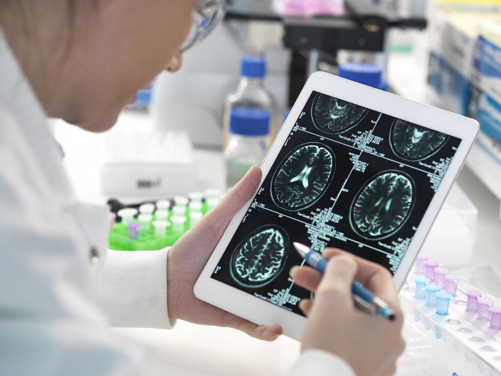 Alzheimer’s drug rejected for NHS use