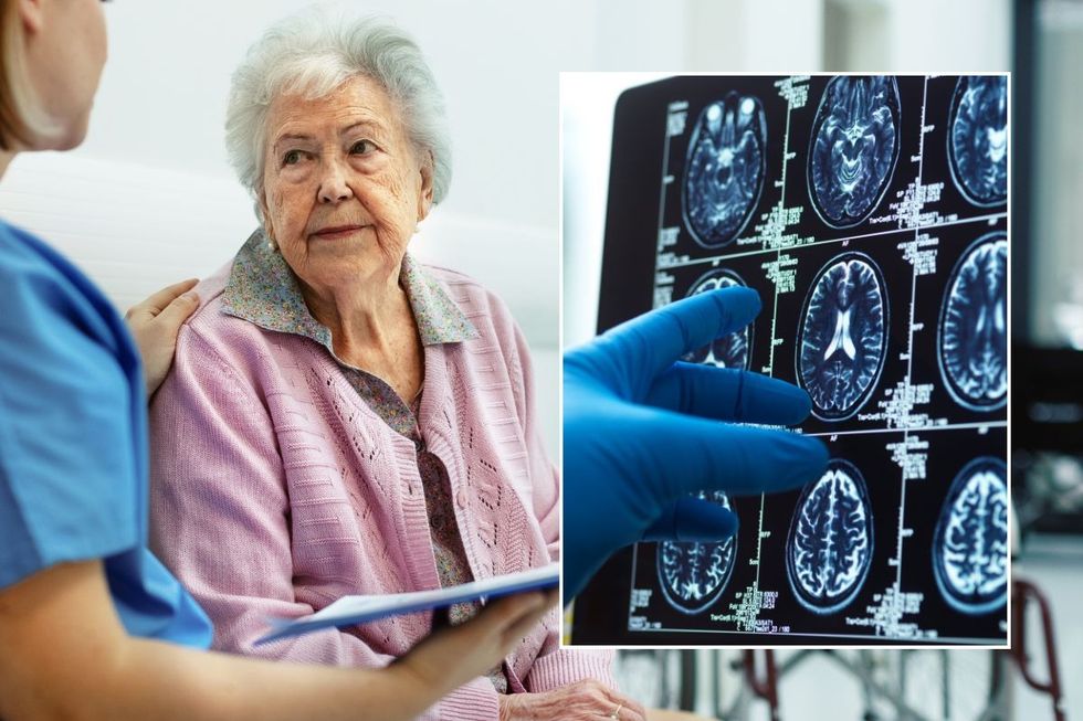 Dementia scan and elderly person