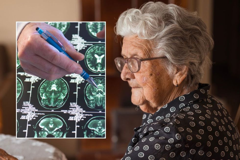 DEMENTIA SCAN AND SENIOR WOMAN