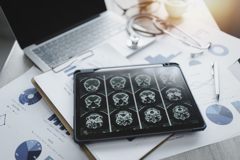 DEMENTIA SCAN