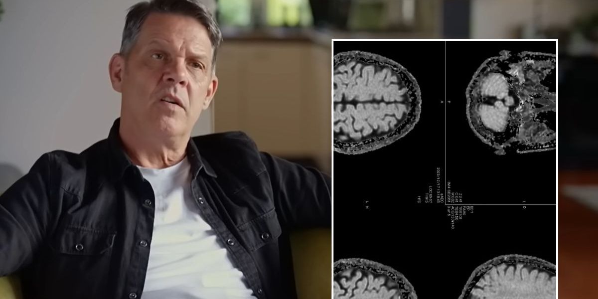 NextImg:Briton, 58, says partner and colleagues noticed troubling dementia sign 'years' before diagnosis