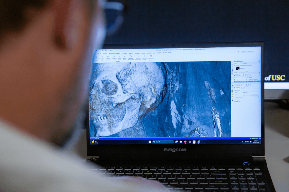 Detail from CT scans