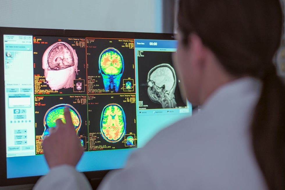 DOCTOR CHECKING BRAIN SCANS