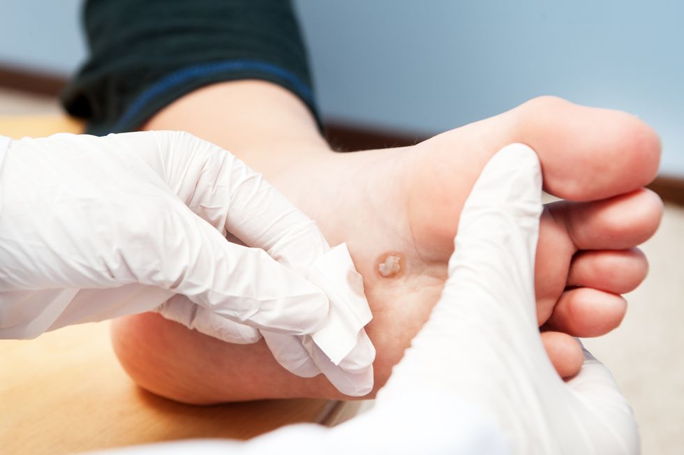 Doctor examining cut on a person's foot