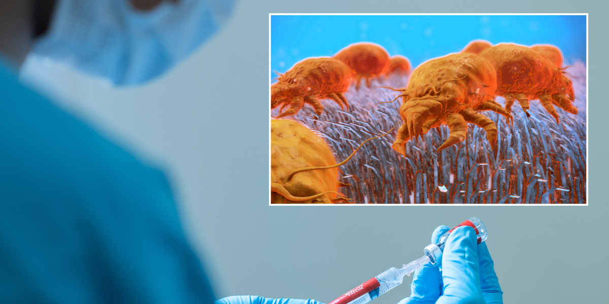 NextImg:Plague: 43-year-old man tests positive as top health chief warns of 'severe threat' posed by ancient disease