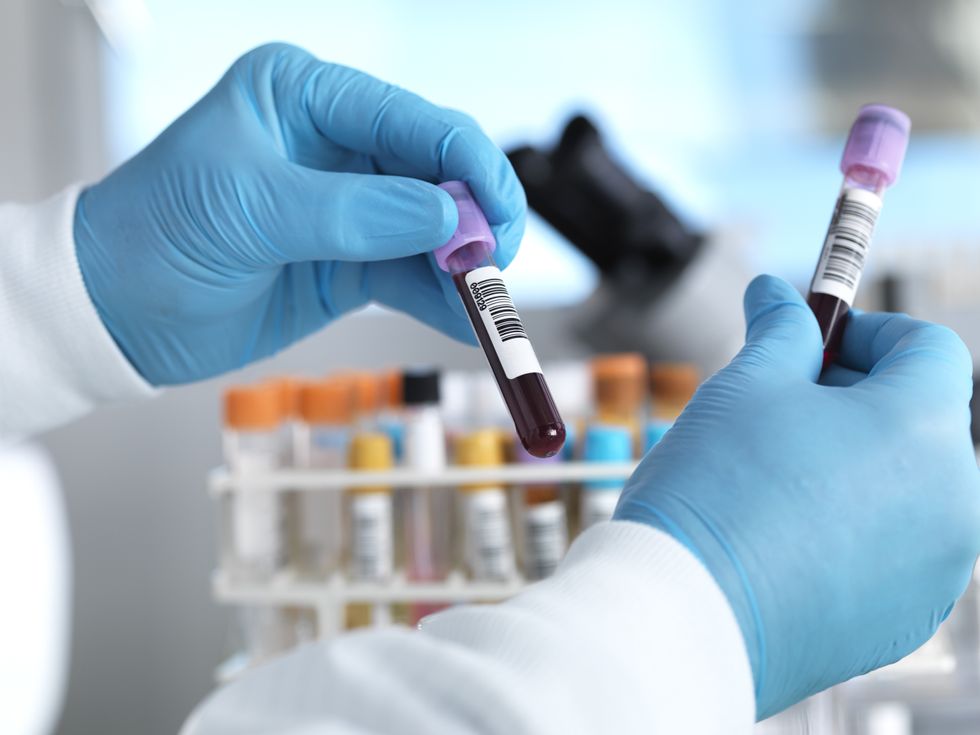 DOCTOR HOLDING BLOOD VIAL