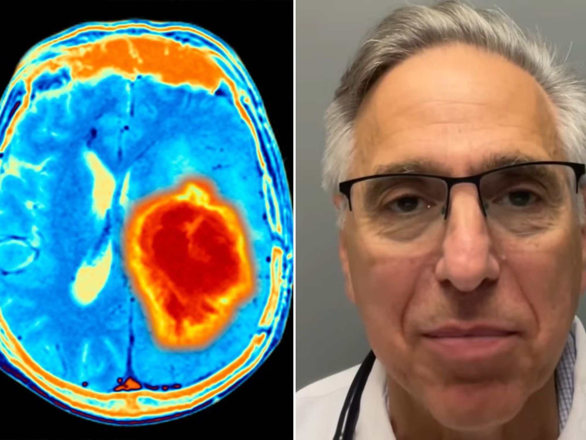 Dr Evan Levine and Brain Scan