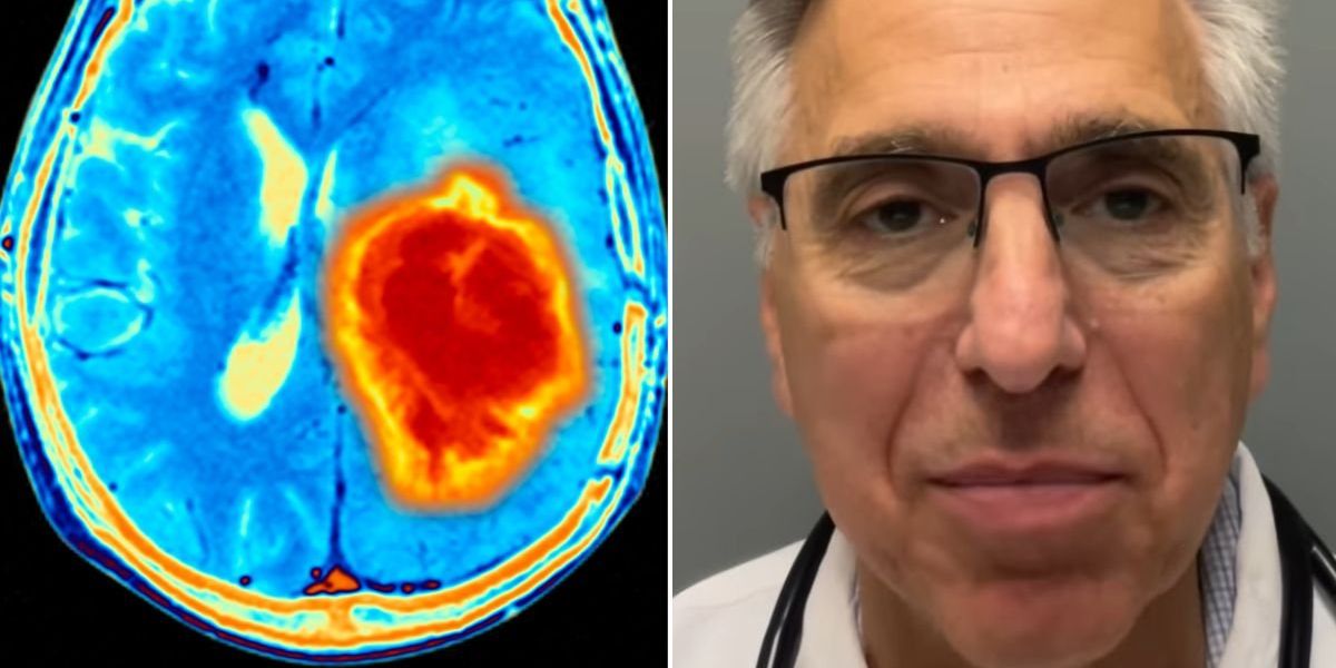 NextImg:Heart specialist warns everyday habits could be quietly raising your risk of aneurysm - 'I see them over and over again'
