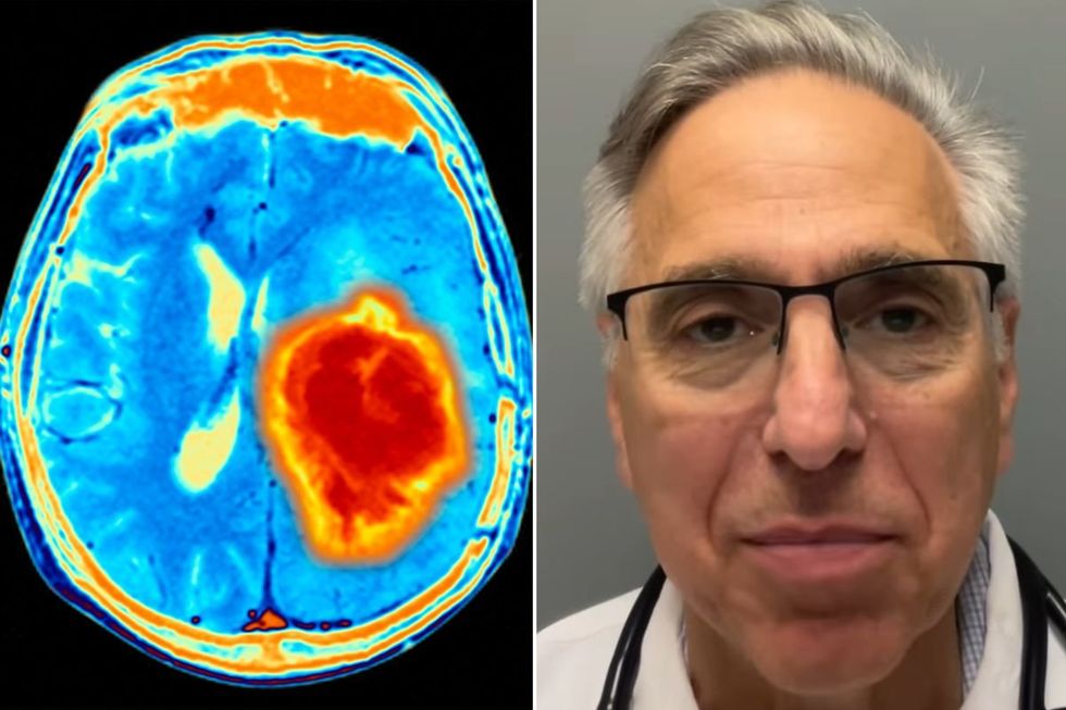 Dr Evan Levine and Brain Scan