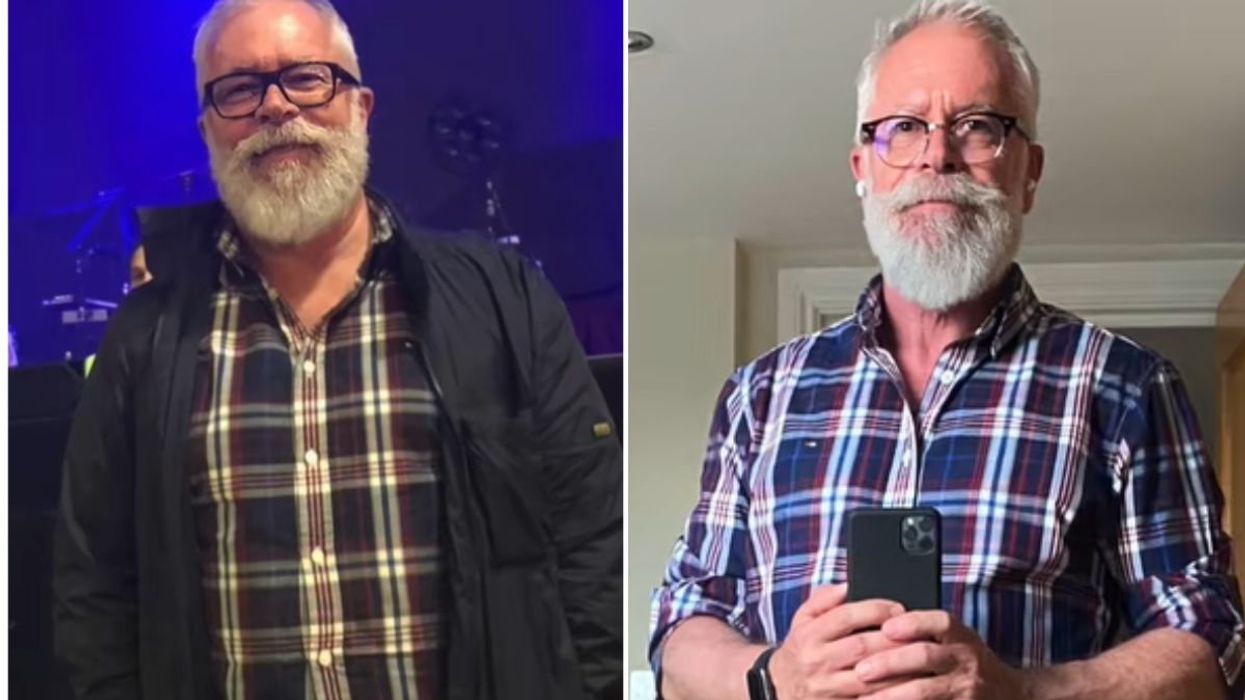 Dr Provan before and after