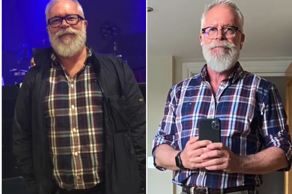 Drew Provan before and after