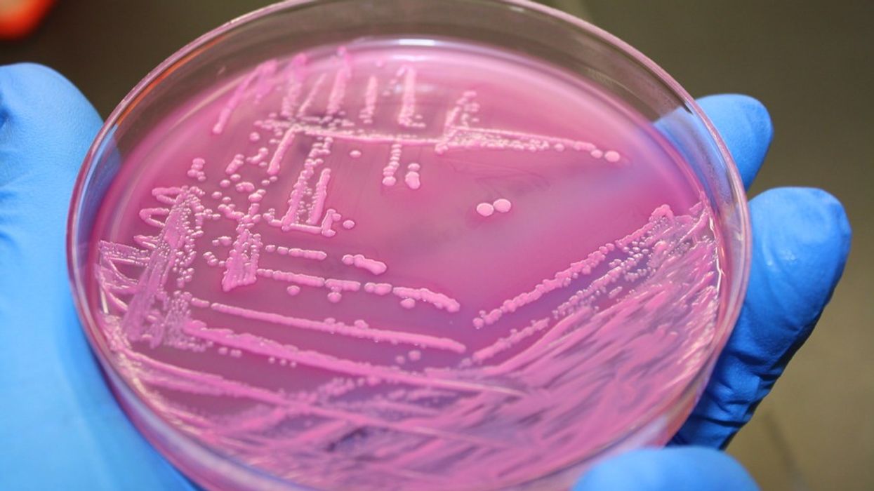 E.Coli in petri dish