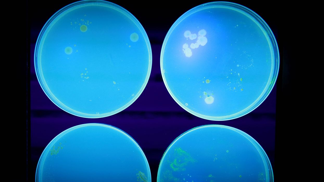 Ecoli