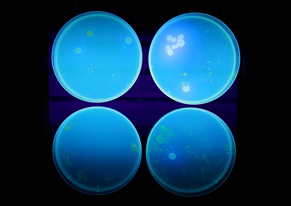 Ecoli