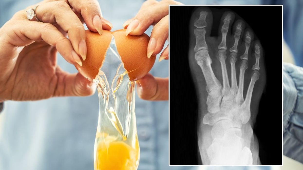 Egg Yolk and foot scan