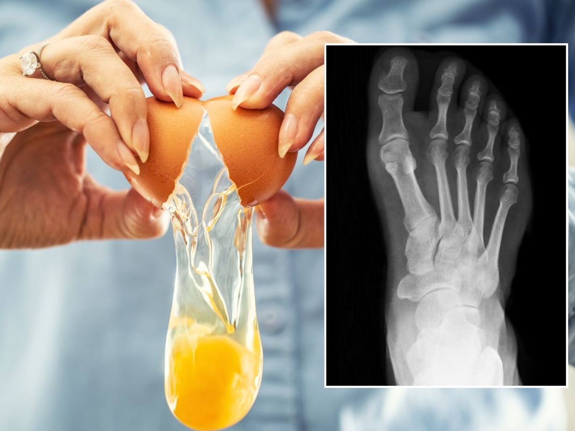 Egg Yolk and foot scan