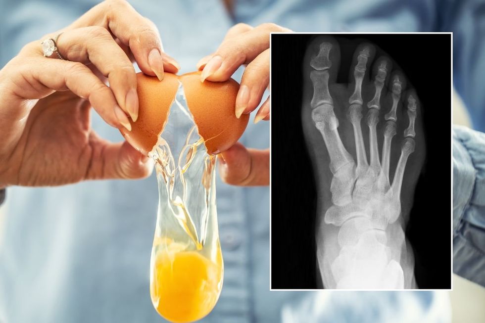 Egg Yolk and foot scan